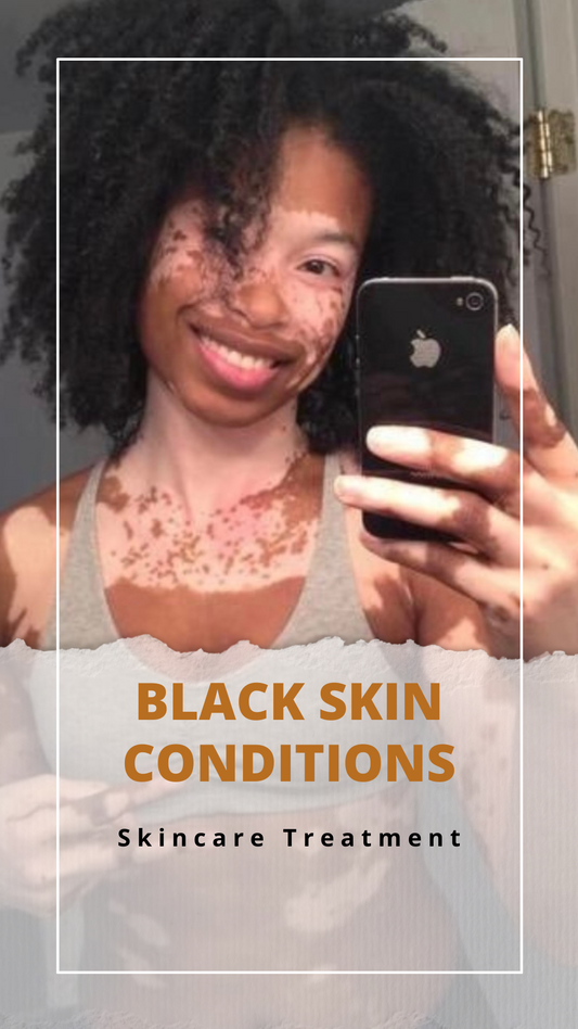 Black Skin Conditions